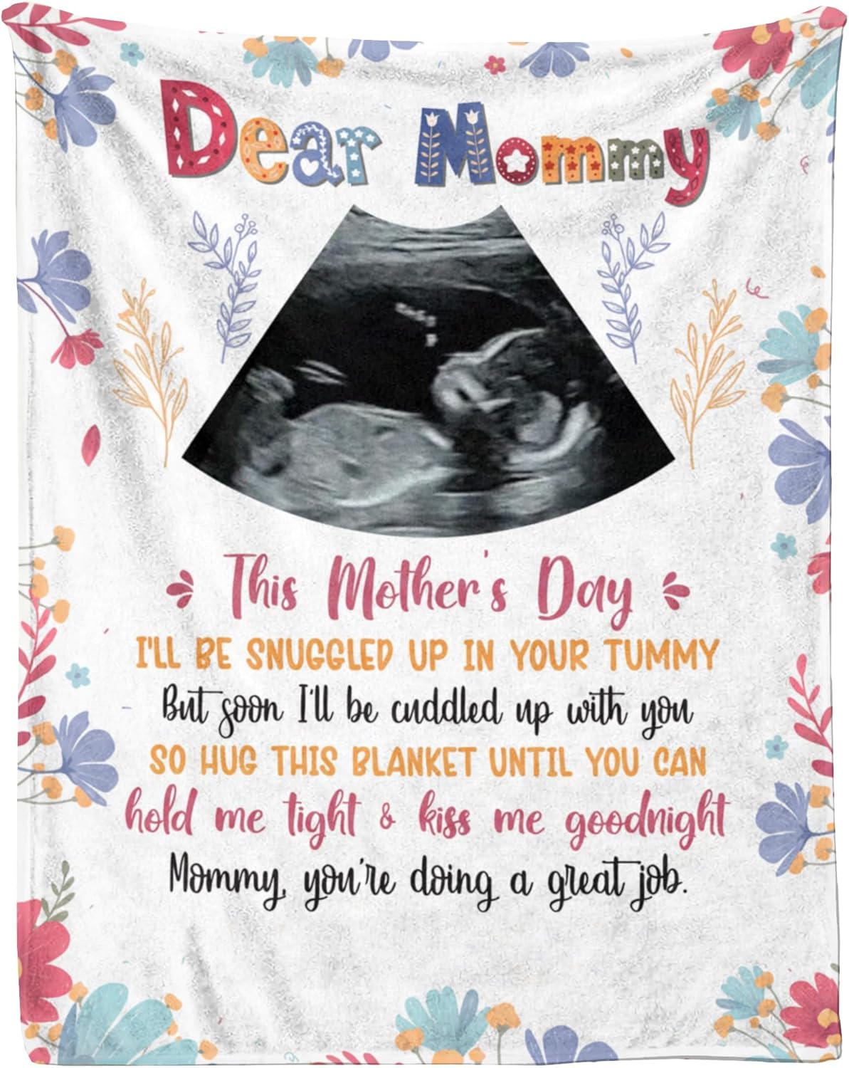 Custom Sonogram Photo Blanket - Personalized Gift for New Mom Mother's Day, Ultrasound Picture Throw for Expecting Mom, Pregnancy Announcement Keepsake Phot Blanket (Style 02)